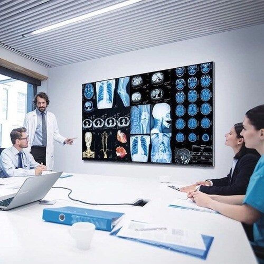Samsung 65-inch professional LCD display showing medical imaging thumbnails