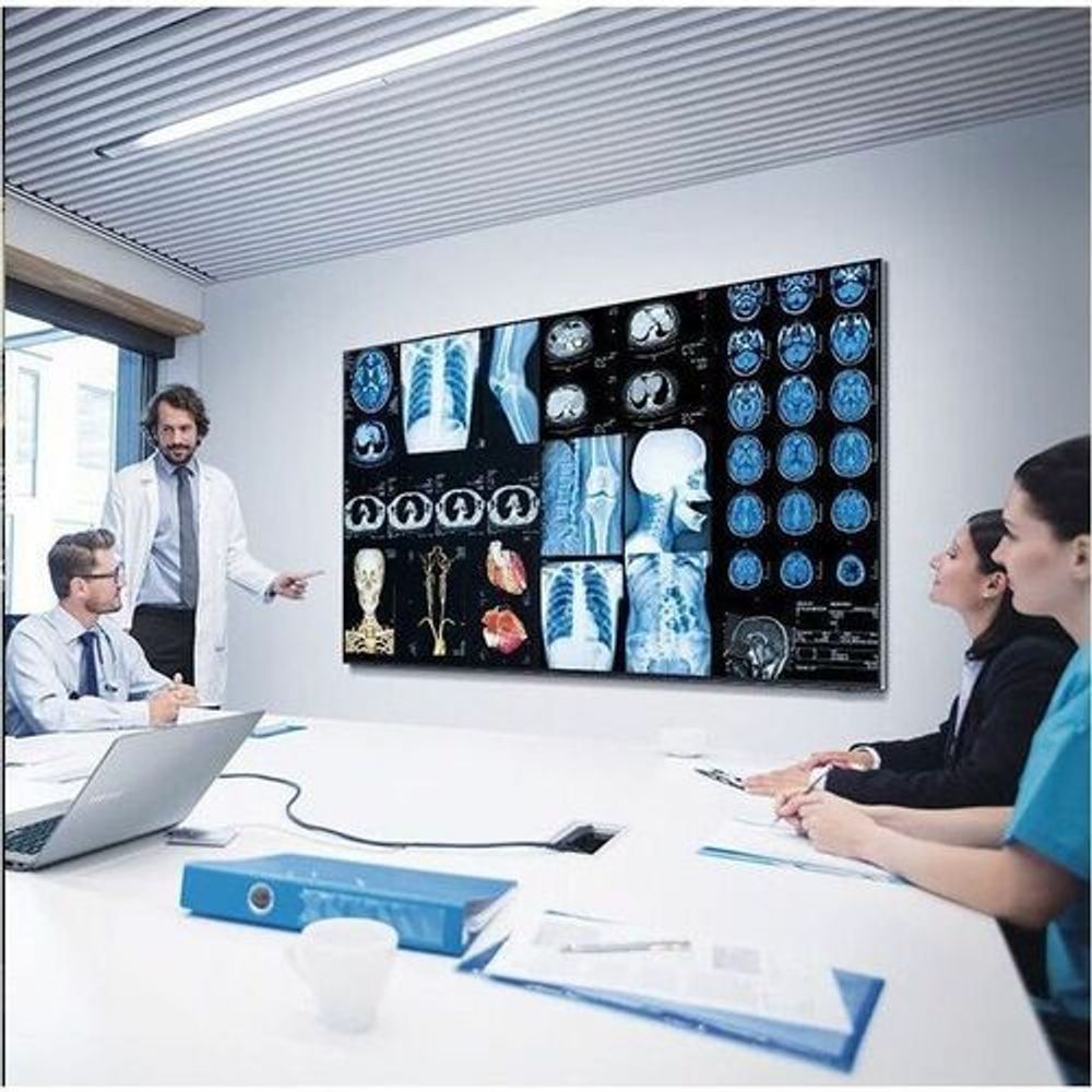 Samsung QH75C 74.5-inch digital signage LCD display showing medical scan graphics