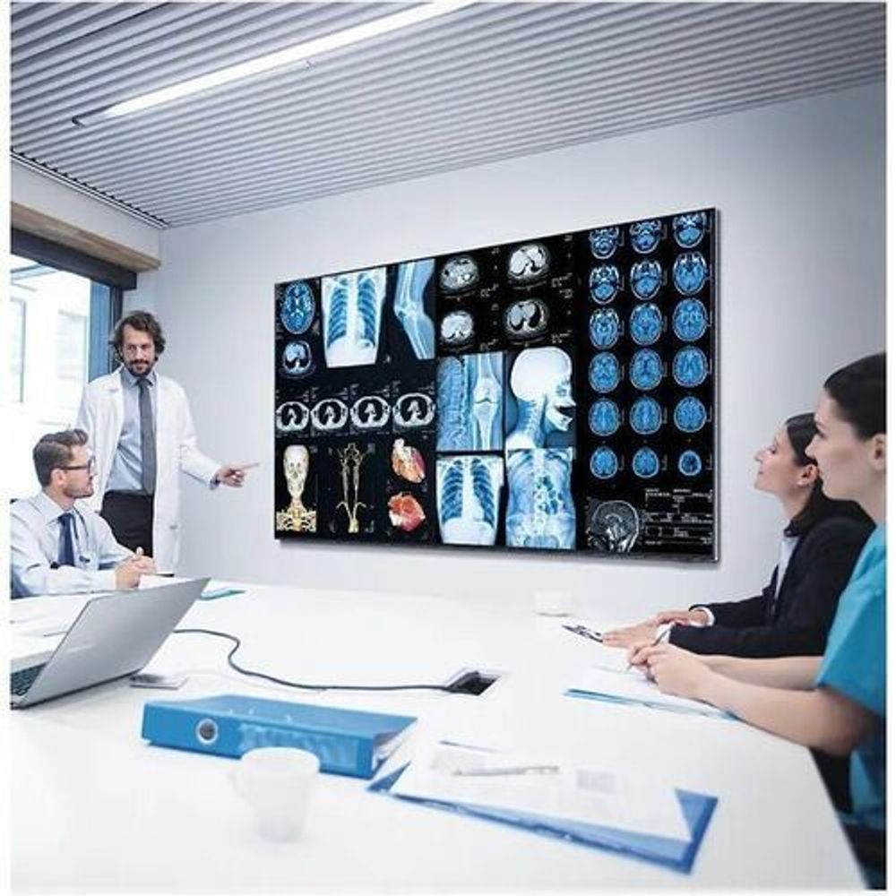 Digital signage display showing medical scan images on screen