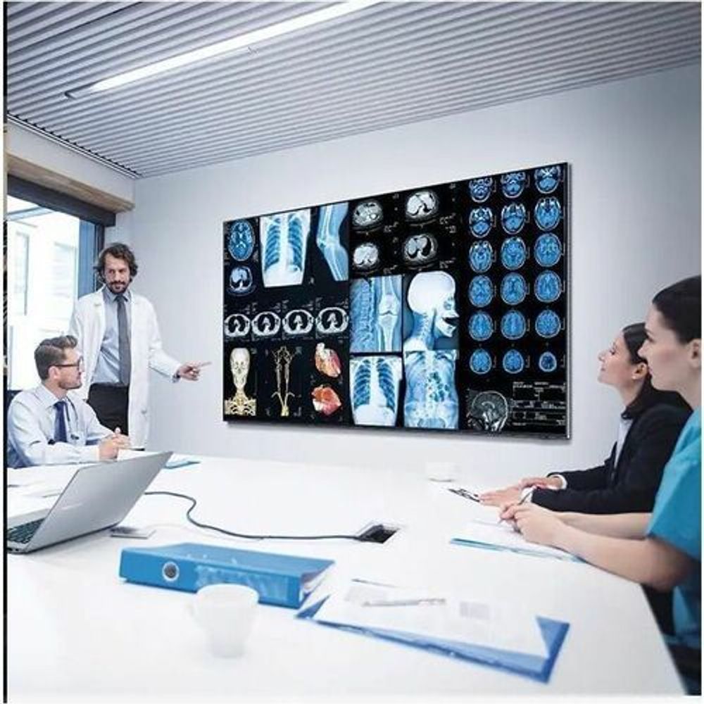 Digital signage display showing medical scan images on screen, black bezel