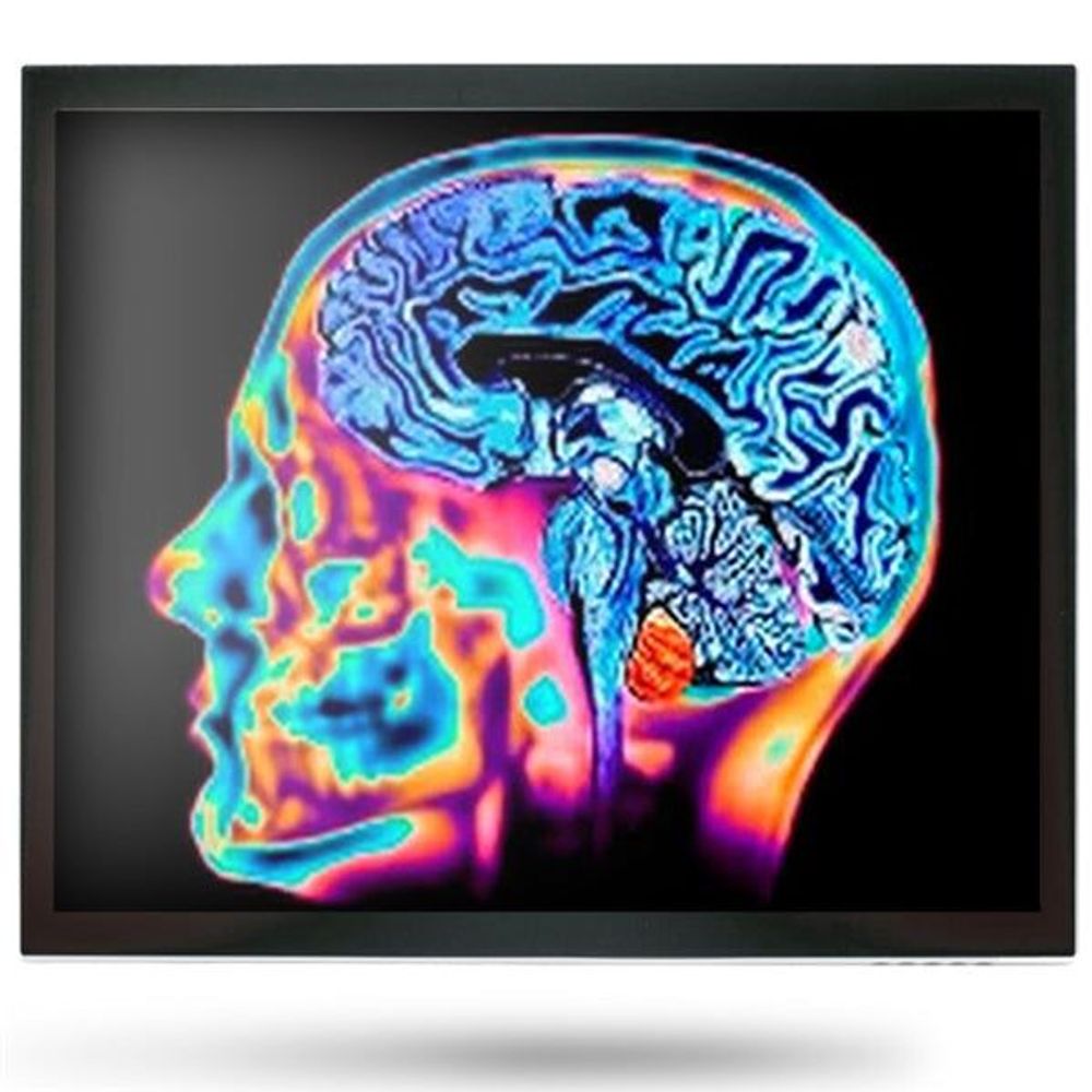 MEDDP-415HNN-A1-1010 - Onyx MEDDP-415HNN 15" Medical Display