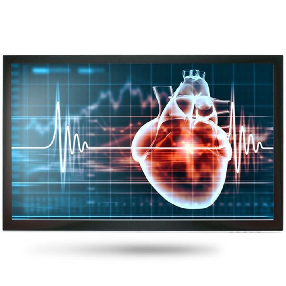 MEDDP-615HPN-A1-1010 - Onyx MEDDP-615HPN 15.6" Medical Touch Display