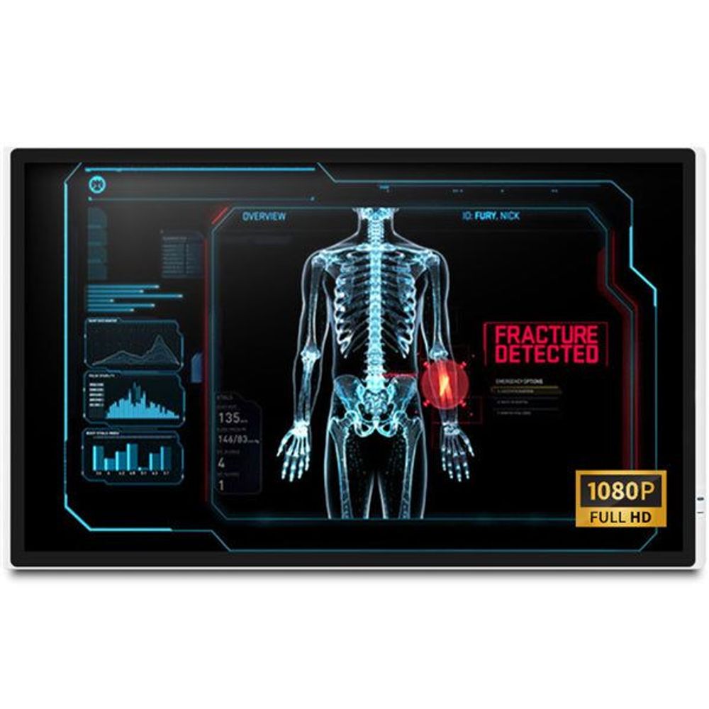 MEDDP-632F-P1-A1-001 - Onyx MEDDP-632F-P1 32" FHD Medical Touch Display