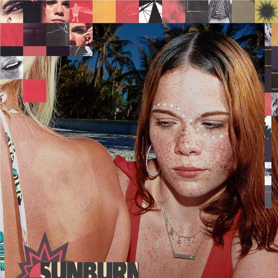 Sunburn, By: Fike, Dominic