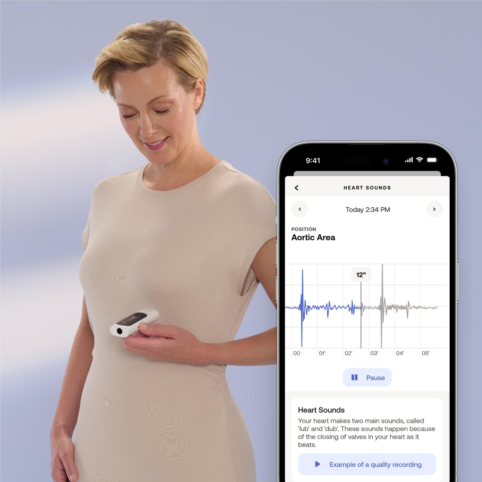 Withings BeamO 4-in-1 Multiscan Device