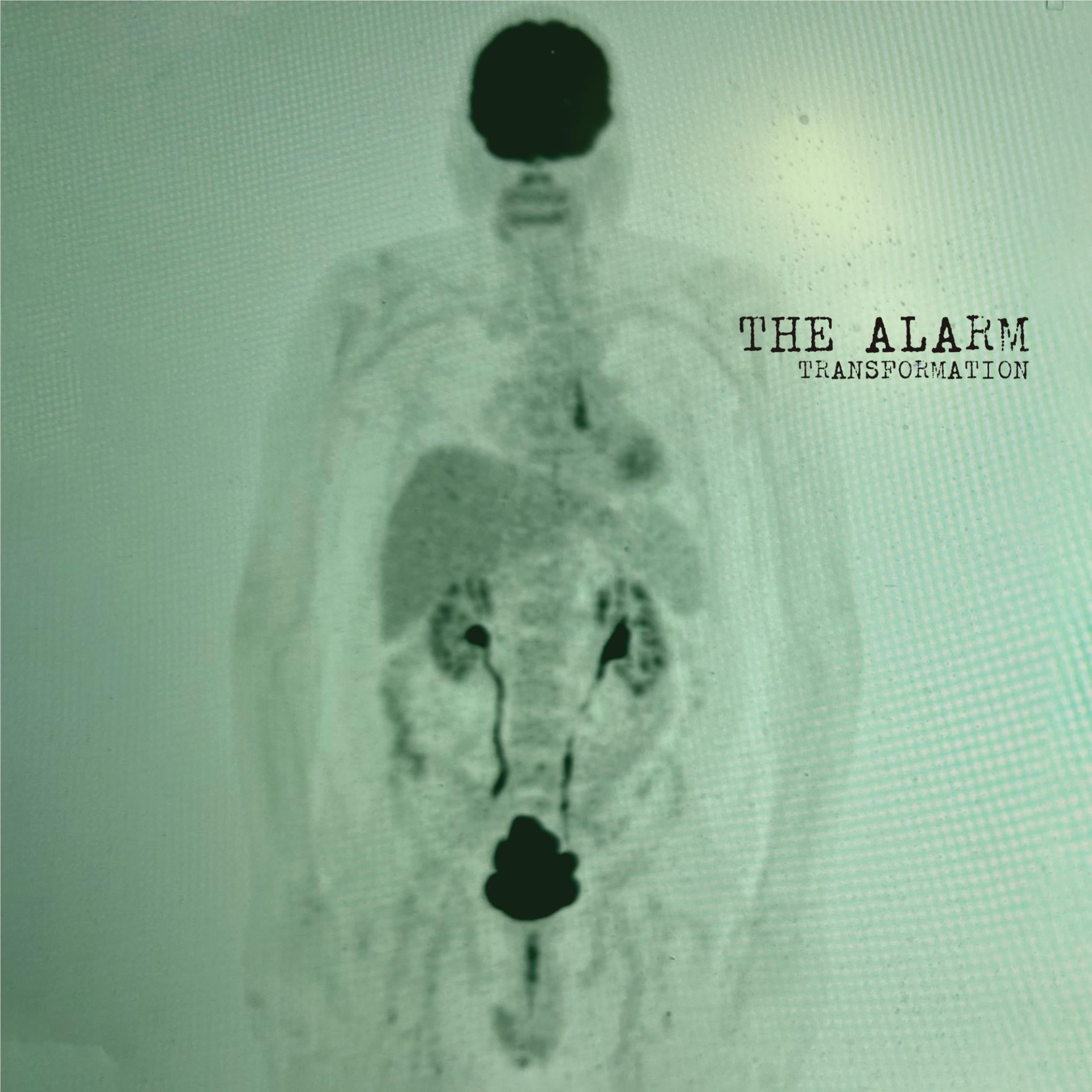 Transformation, By: The Alarm